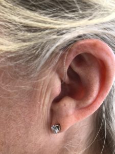 Hearing Aids for Residents in Elberton, Georgia